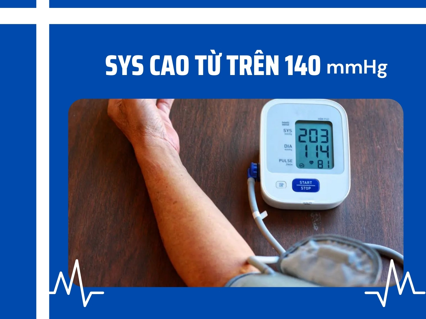 Chỉ số SYS cao ảnh hưởng tới sức khỏe 